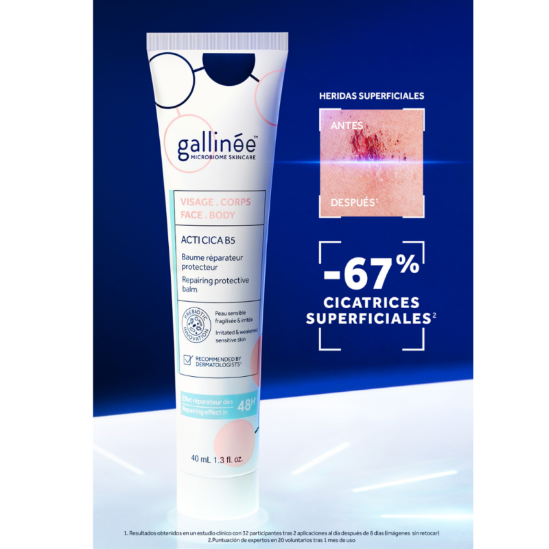 gallinee-cica4